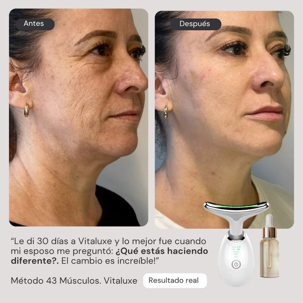 Método Lift Combo™ Vitaluxe